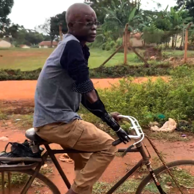 A man rides a bicycle along a dirt path in a rural area. He is wearing a long-sleeved shirt and pants, with a prosthetic arm visible on his left side, gripping the handlebar. The man appears focused, demonstrating how the prosthetic arm allows him to engage in everyday activities. thumbnail