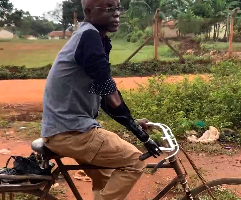 A man rides a bicycle along a dirt path in a rural area. He is wearing a long-sleeved shirt and pants, with a prosthetic arm visible on his left side, gripping the handlebar. The man appears focused, demonstrating how the prosthetic arm allows him to engage in everyday activities.